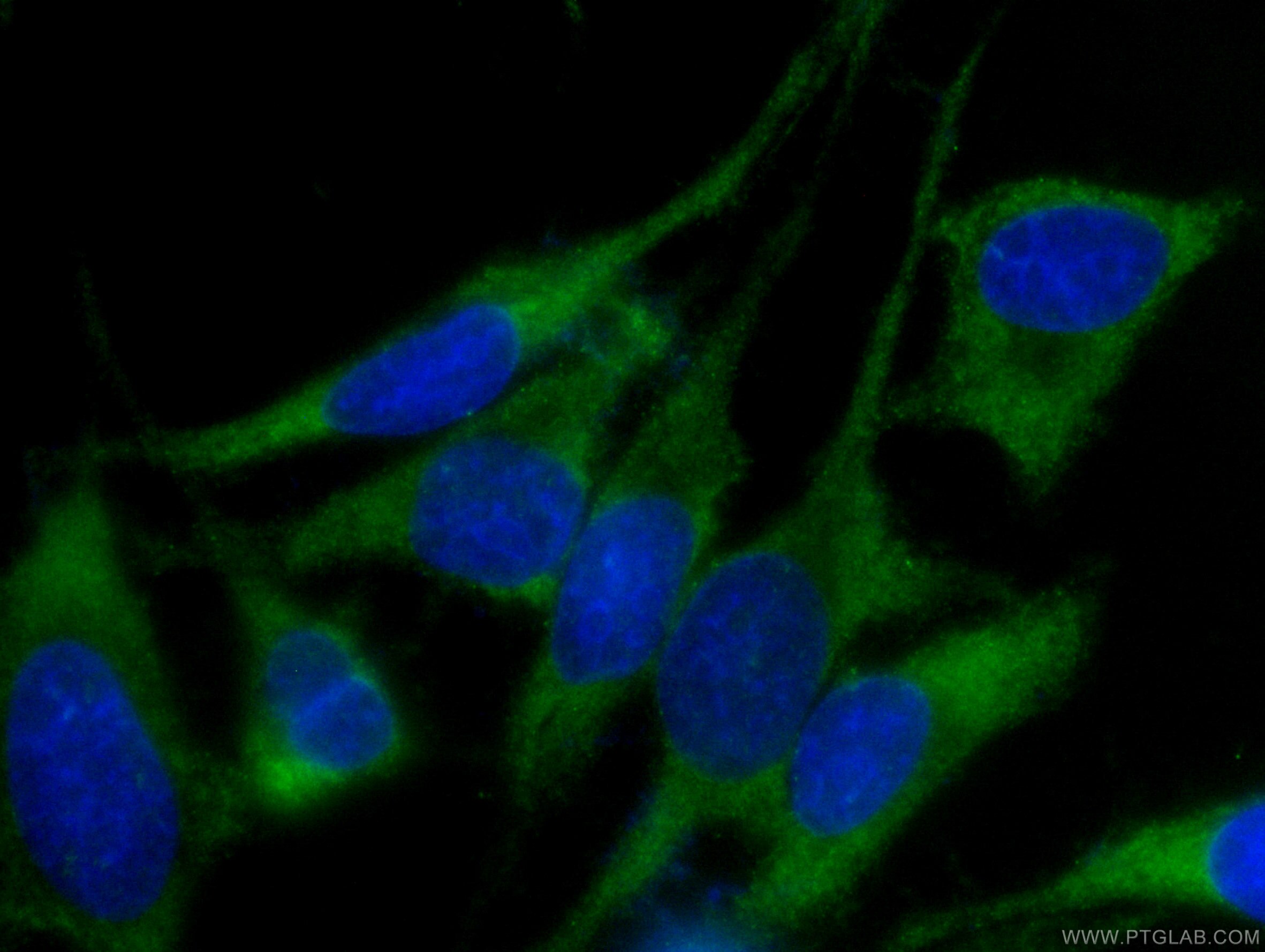 Immunofluorescence (IF) / fluorescent staining of HeLa cells using CoraLite® Plus 488-conjugated EIF3D Monoclonal ant (CL488-66024)