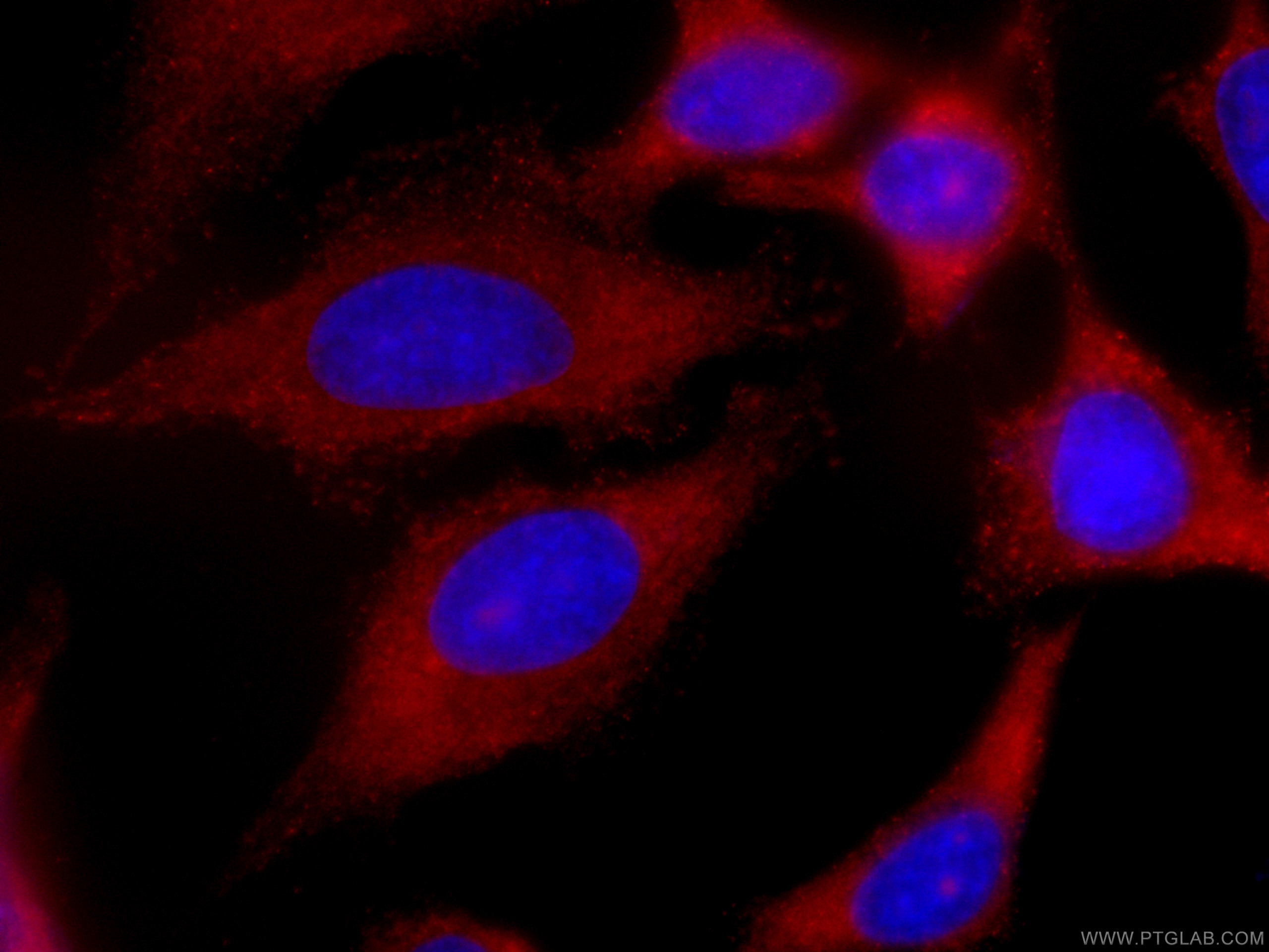 Immunofluorescence (IF) / fluorescent staining of HeLa cells using CoraLite®594-conjugated EIF3D Monoclonal antibody (CL594-66024)