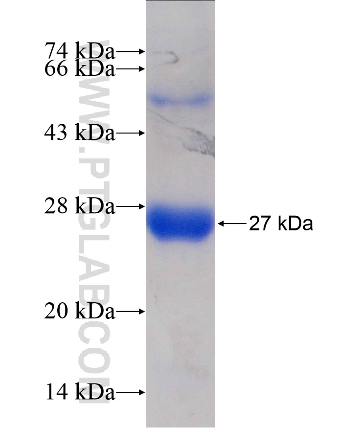 EIF3D fusion protein Ag18092 SDS-PAGE