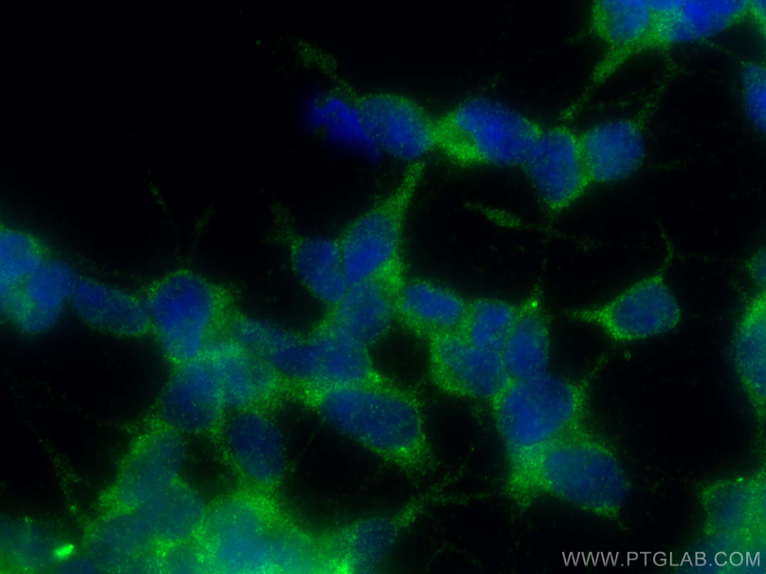 Immunofluorescence (IF) / fluorescent staining of SH-SY5Y cells using EIF3E Polyclonal antibody (10899-1-AP)