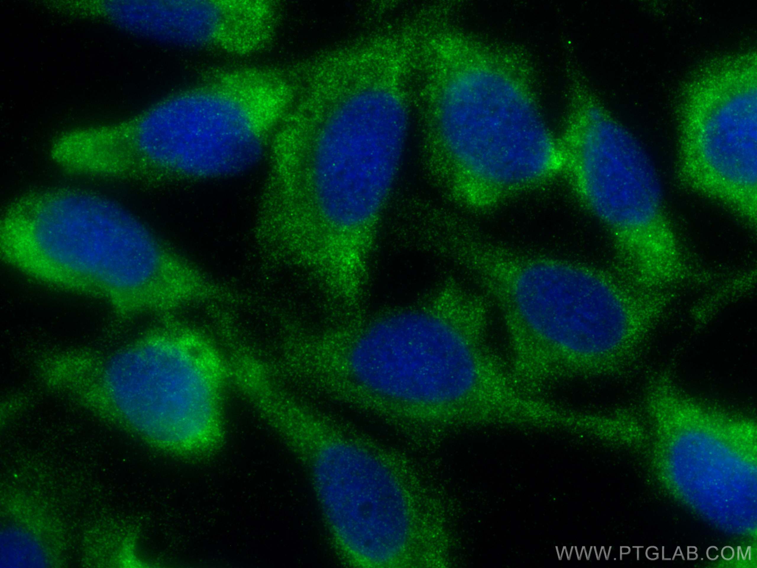 Immunofluorescence (IF) / fluorescent staining of U2OS cells using EIF3E Polyclonal antibody (10899-1-AP)
