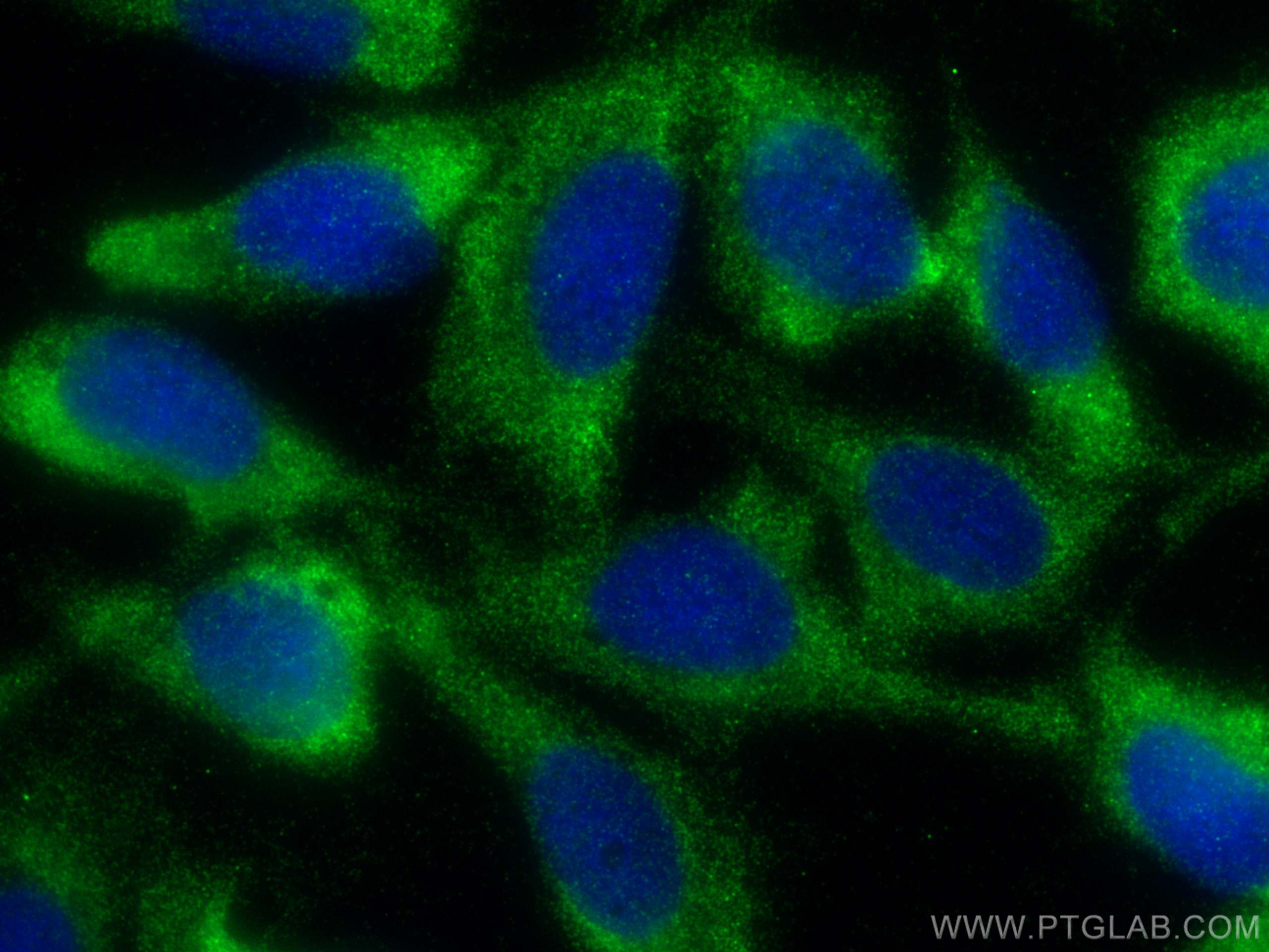 IF Staining of U2OS using 10899-1-AP