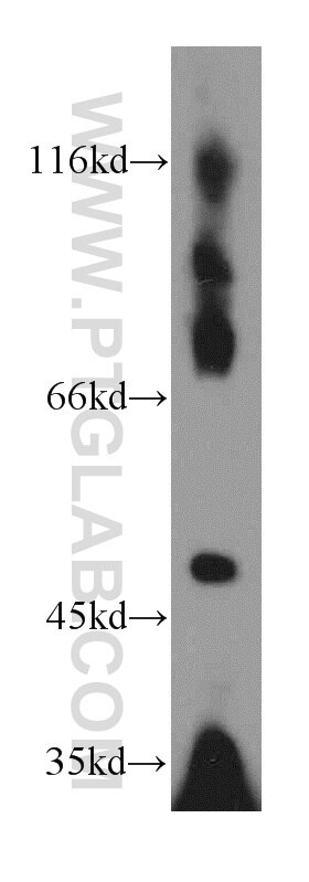 Western Blot (WB) analysis of mouse thymus tissue using EIF3E Polyclonal antibody (10899-1-AP)