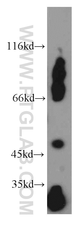 Western Blot (WB) analysis of mouse pancreas tissue using EIF3E Polyclonal antibody (10899-1-AP)