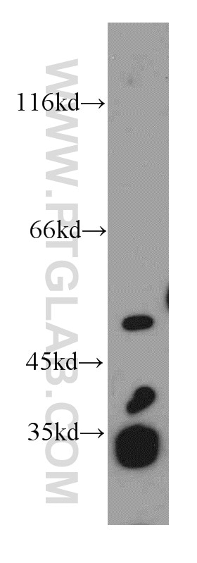 Western Blot (WB) analysis of Jurkat cells using EIF3E Polyclonal antibody (10899-1-AP)