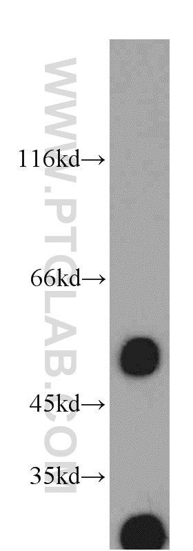 Western Blot (WB) analysis of rat lymph tissue using EIF3E Polyclonal antibody (10899-1-AP)