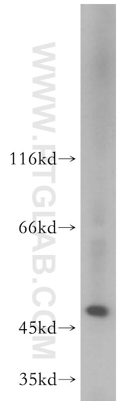 Western Blot (WB) analysis of Jurkat cells using EIF3E Polyclonal antibody (11352-1-AP)