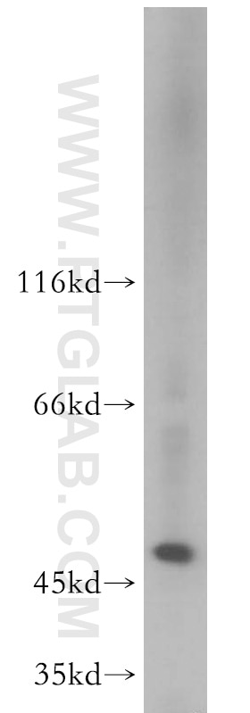 WB analysis of Jurkat using 11352-1-AP