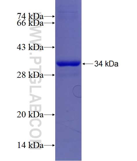 EIF3E fusion protein Ag28523 SDS-PAGE