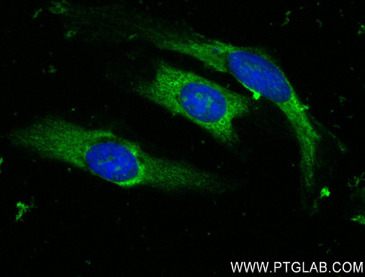 Immunofluorescence (IF) / fluorescent staining of HeLa cells using EIF3F Recombinant antibody (84131-2-RR)