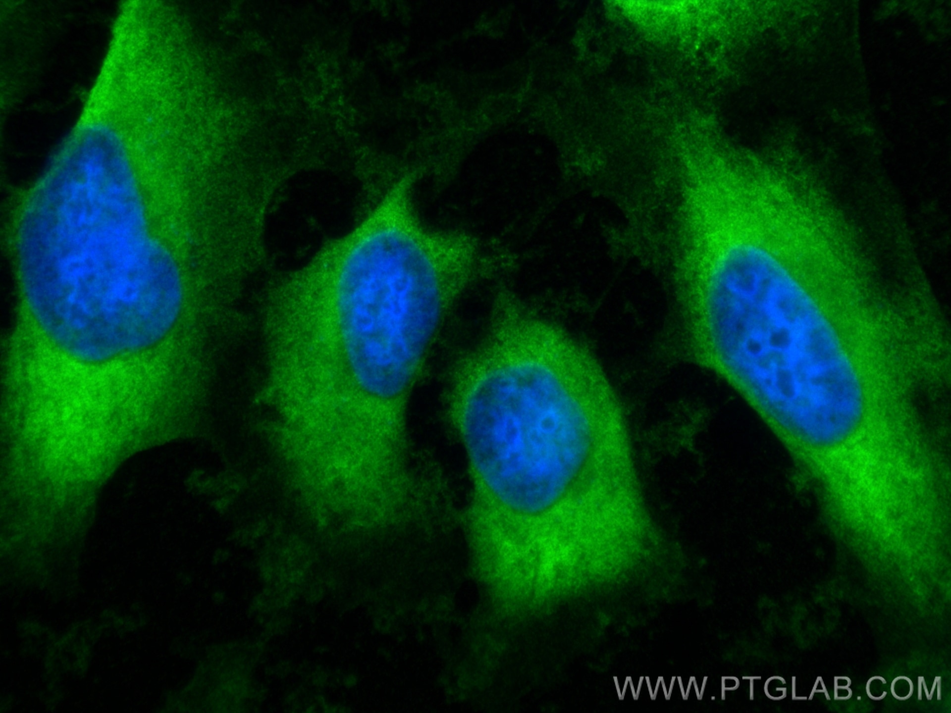 Immunofluorescence (IF) / fluorescent staining of HeLa cells using EIF3F Recombinant antibody (84131-2-RR)