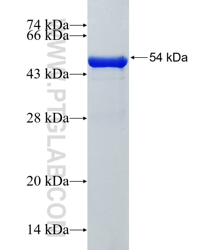 EIF3F fusion protein Ag34849 SDS-PAGE