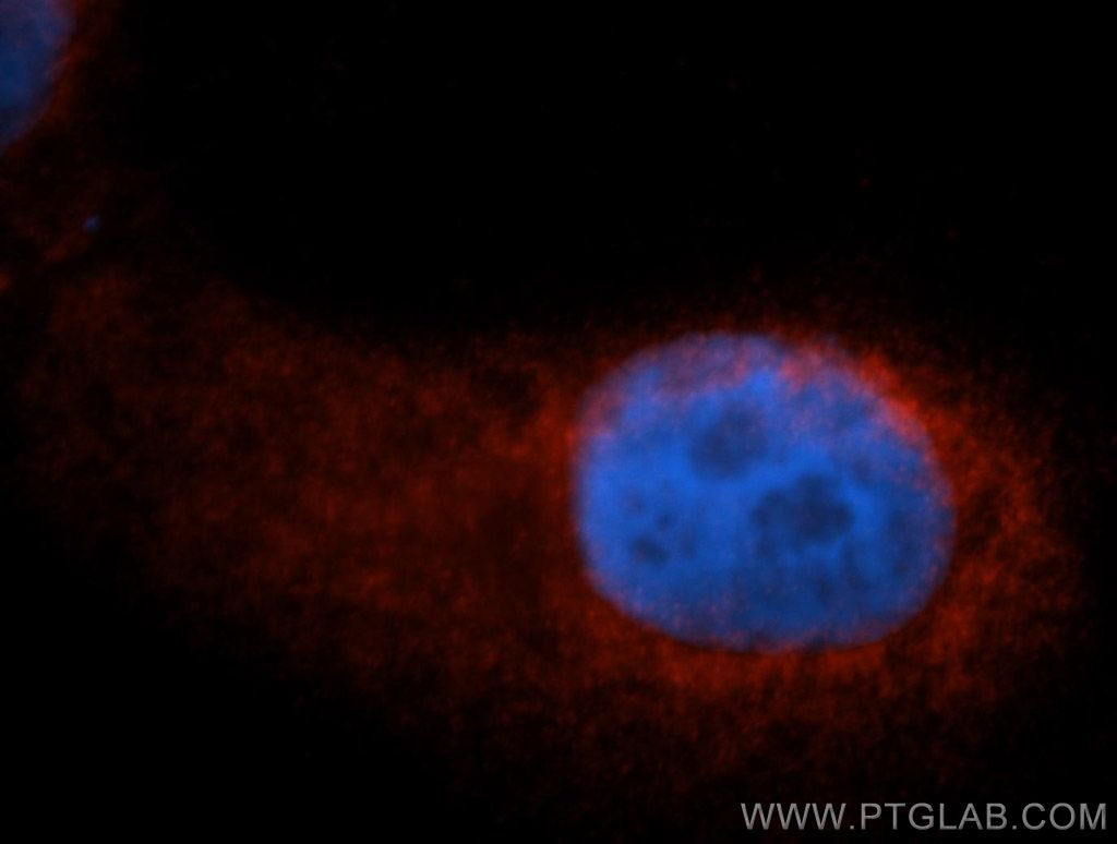 Immunofluorescence (IF) / fluorescent staining of A549 cells using EIF3G Polyclonal antibody (11165-1-AP)