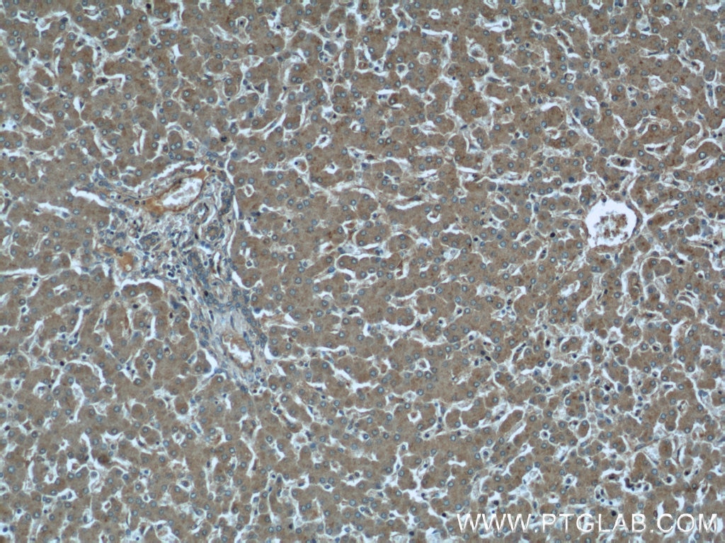 Immunohistochemistry (IHC) staining of human liver tissue using EIF3I Polyclonal antibody (11287-1-AP)