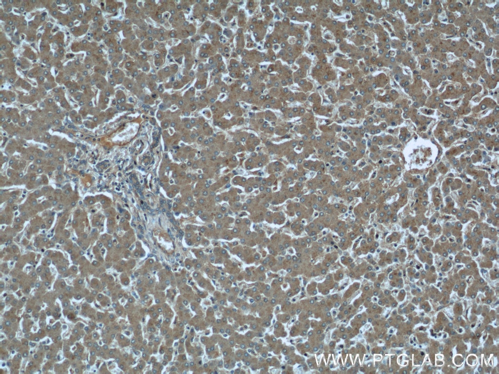 IHC staining of human liver using 11287-1-AP