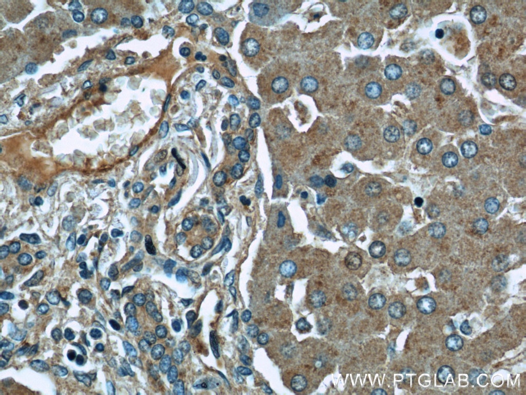 Immunohistochemistry (IHC) staining of human liver tissue using EIF3I Polyclonal antibody (11287-1-AP)