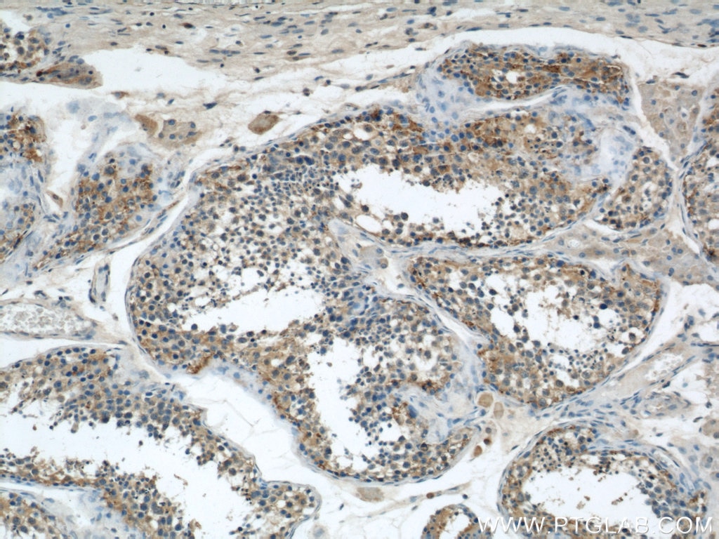 Immunohistochemistry (IHC) staining of human testis tissue using EIF3I Polyclonal antibody (11287-1-AP)