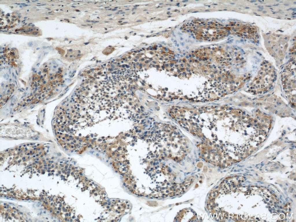 IHC staining of human testis using 11287-1-AP