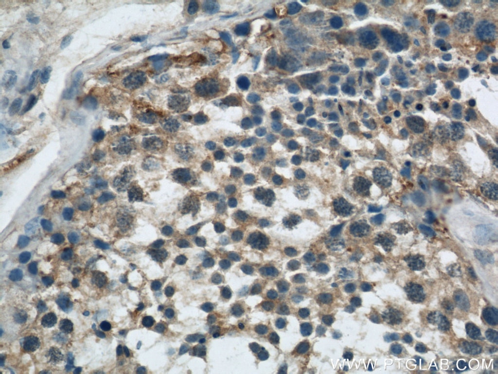 Immunohistochemistry (IHC) staining of human testis tissue using EIF3I Polyclonal antibody (11287-1-AP)