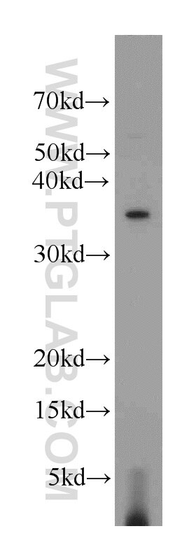 Western Blot (WB) analysis of Jurkat cells using EIF3I Polyclonal antibody (11287-1-AP)