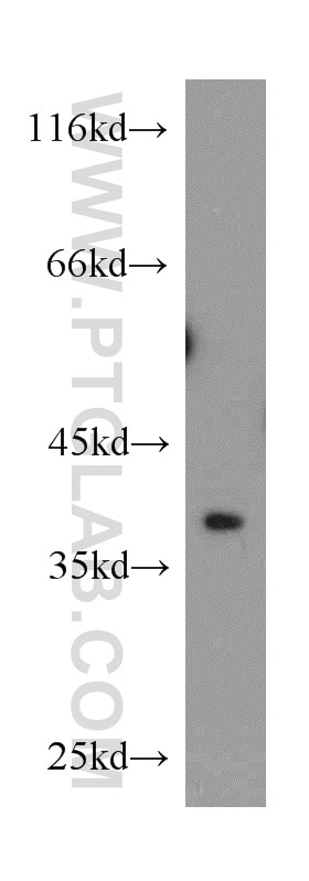 Western Blot (WB) analysis of SH-SY5Y cells using EIF3I Polyclonal antibody (11287-1-AP)