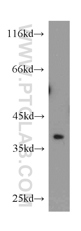 WB analysis of SH-SY5Y using 11287-1-AP