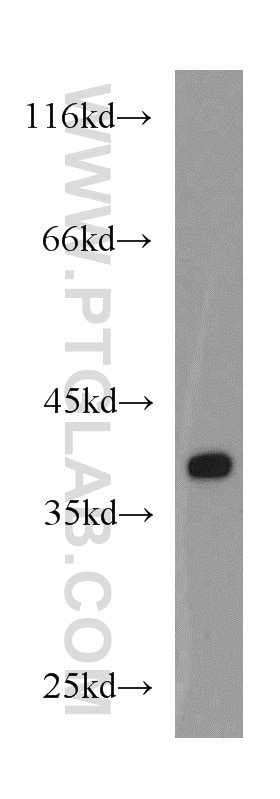 Western Blot (WB) analysis of human placenta tissue using EIF3I Polyclonal antibody (11287-1-AP)