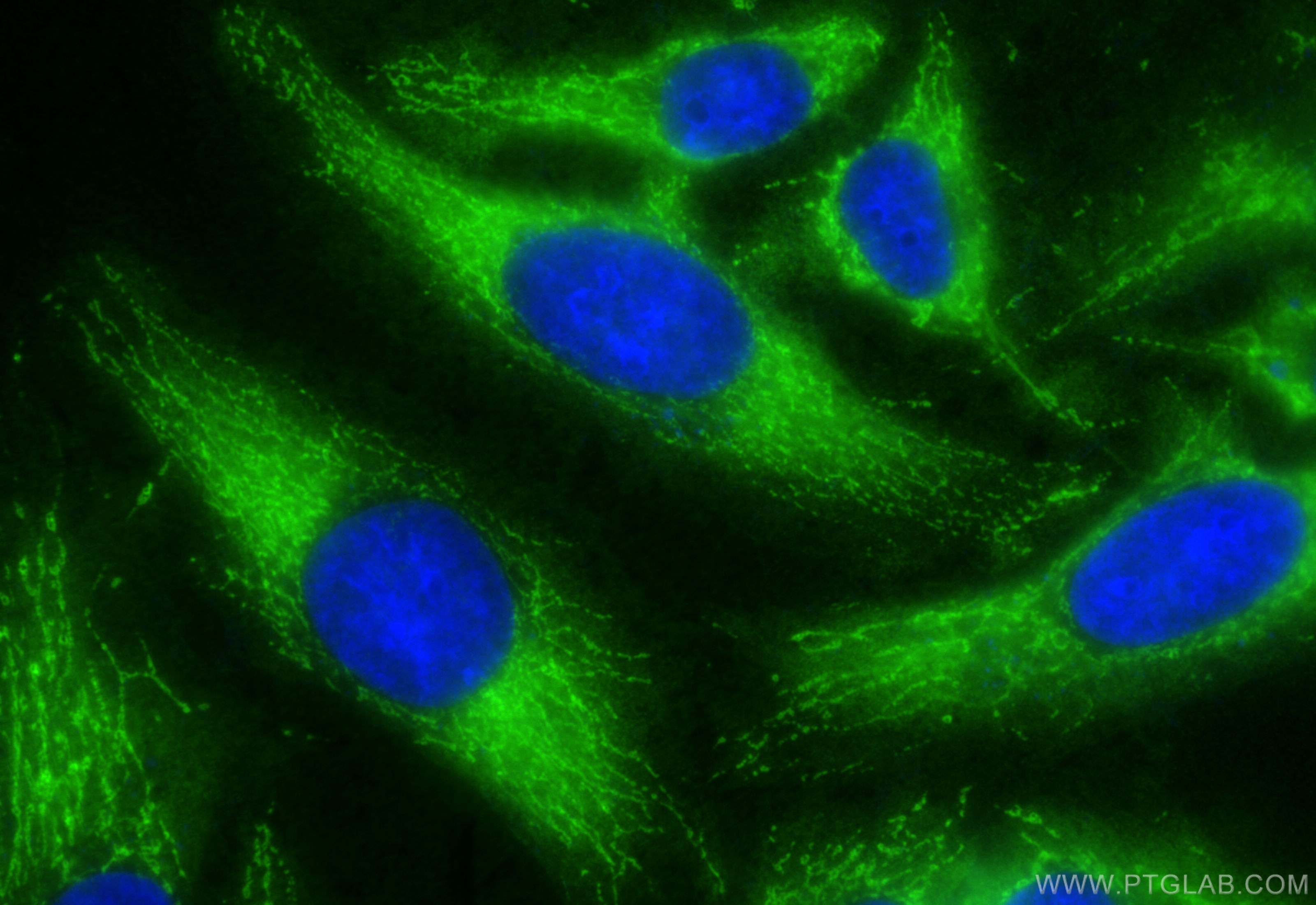 Immunofluorescence (IF) / fluorescent staining of HeLa cells using EIF3J Polyclonal antibody (10439-1-AP)