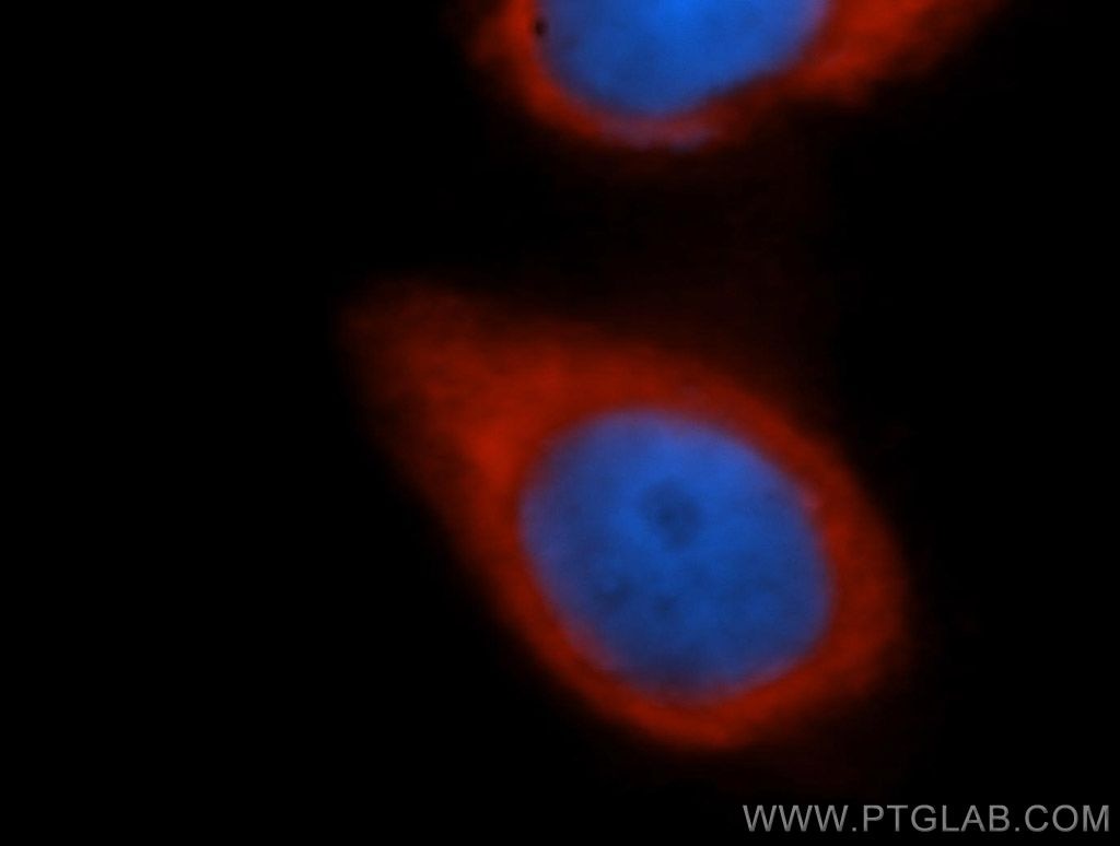 Immunofluorescence (IF) / fluorescent staining of HeLa cells using EIF3J Polyclonal antibody (10439-1-AP)