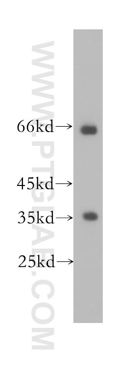 Western Blot (WB) analysis of HeLa cells using EIF3J Polyclonal antibody (10439-1-AP)