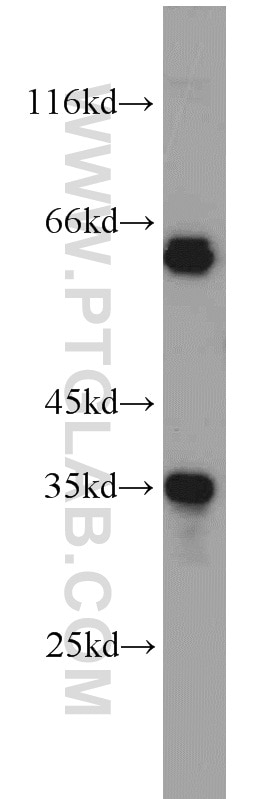 Western Blot (WB) analysis of HeLa cells using EIF3J Polyclonal antibody (10439-1-AP)