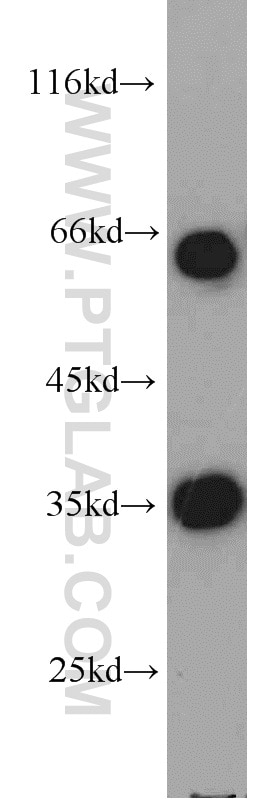 Western Blot (WB) analysis of HeLa cells using EIF3J Polyclonal antibody (10439-1-AP)