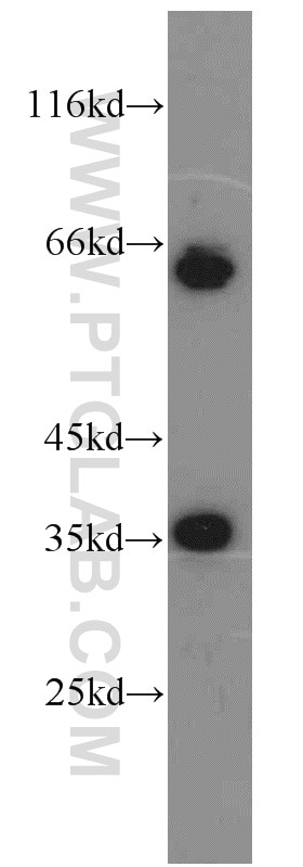 Western Blot (WB) analysis of MCF-7 cells using EIF3J Polyclonal antibody (10439-1-AP)
