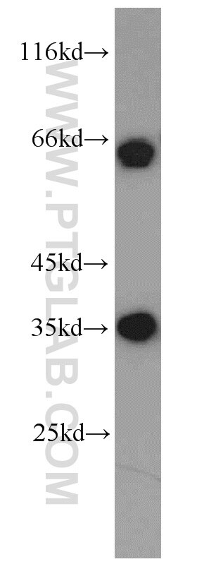 Western Blot (WB) analysis of Jurkat cells using EIF3J Polyclonal antibody (10439-1-AP)