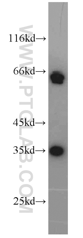 Western Blot (WB) analysis of HEK-293 cells using EIF3J Polyclonal antibody (10439-1-AP)