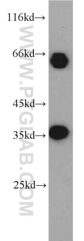 Western Blot (WB) analysis of K-562 cells using EIF3J Polyclonal antibody (10439-1-AP)