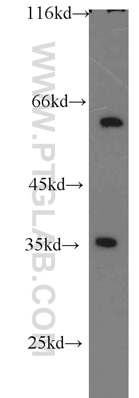 Western Blot (WB) analysis of SKOV-3 cells using EIF3J Polyclonal antibody (10439-1-AP)