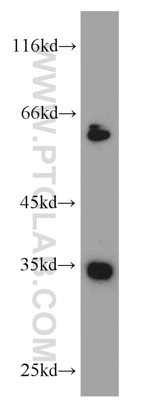 Western Blot (WB) analysis of HeLa cells using EIF3J Polyclonal antibody (10439-1-AP)