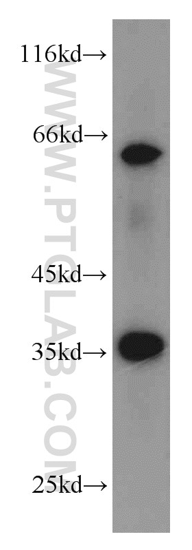 Western Blot (WB) analysis of A549 cells using EIF3J Polyclonal antibody (10439-1-AP)