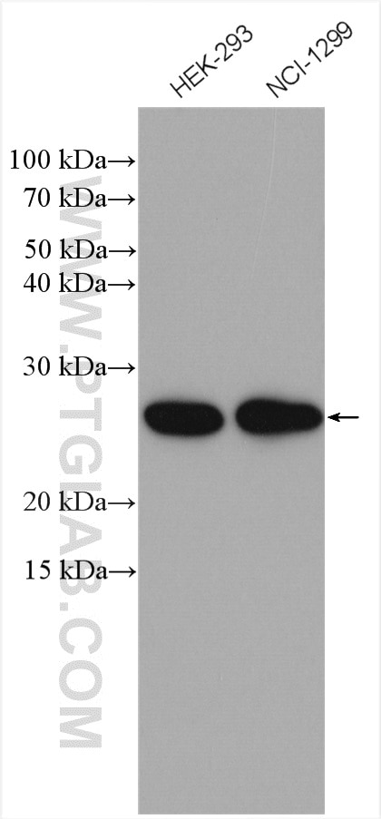 Western Blot (WB) analysis of various lysates using EIF3K Polyclonal antibody (10640-1-AP)