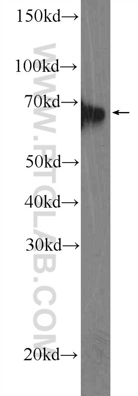 Western Blot (WB) analysis of mouse brain tissue using EIF3L Polyclonal antibody (11482-1-AP)