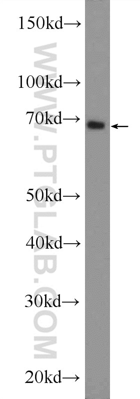 Western Blot (WB) analysis of mouse brain tissue using EIF3L Polyclonal antibody (11482-1-AP)