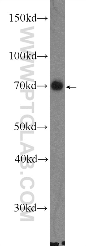 Western Blot (WB) analysis of rat brain tissue using EIF3L Polyclonal antibody (11482-1-AP)