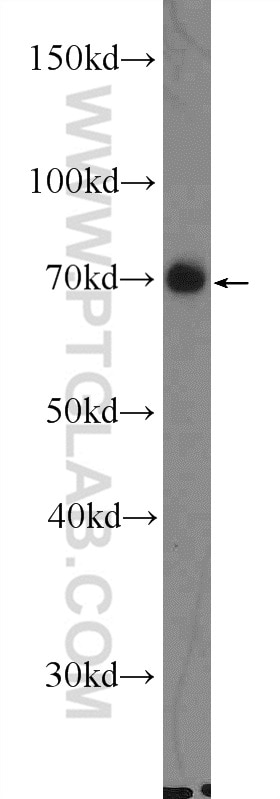 WB analysis of rat brain using 11482-1-AP