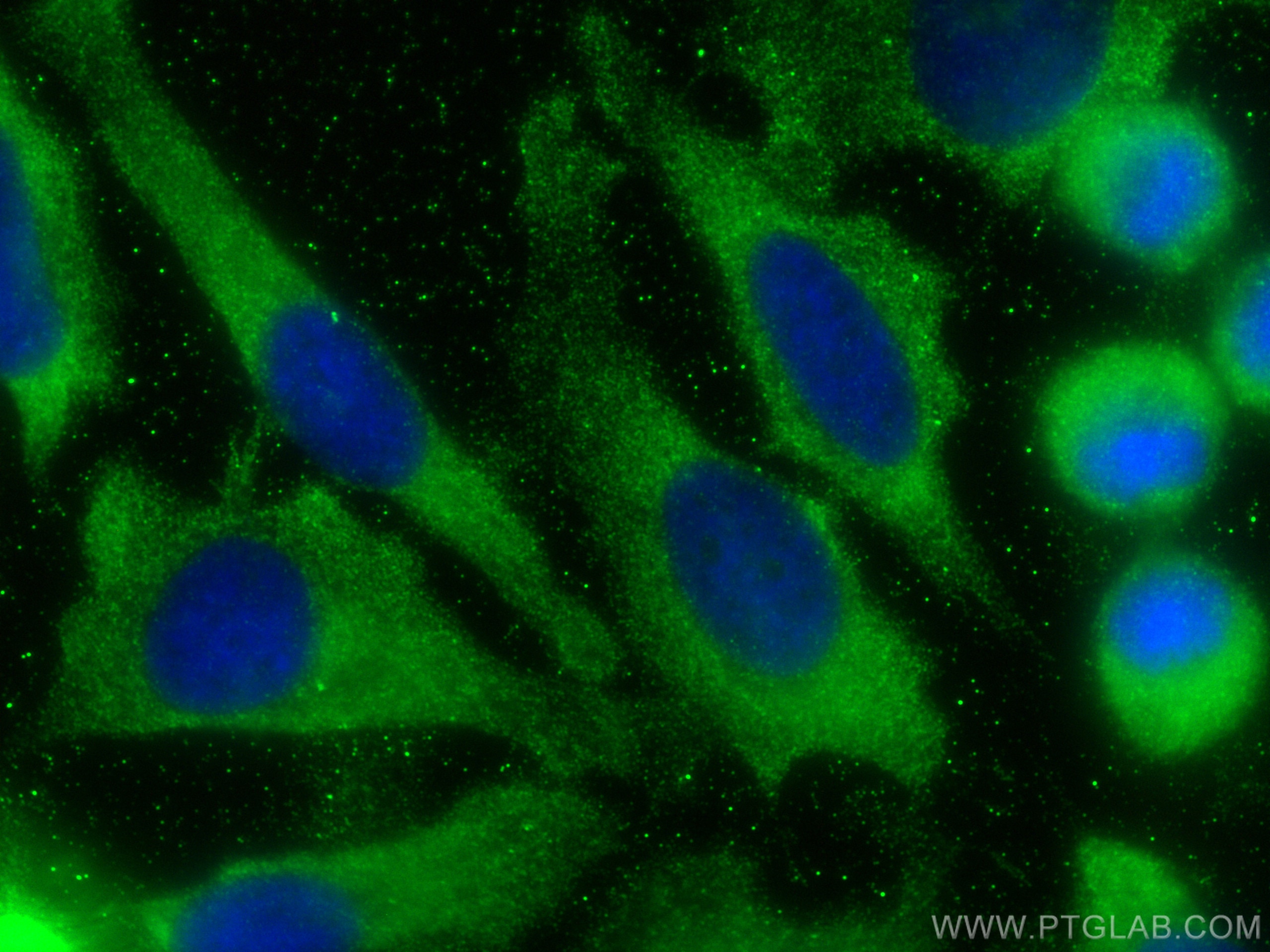 Immunofluorescence (IF) / fluorescent staining of HeLa cells using EIF3L Monoclonal antibody (67719-1-Ig)