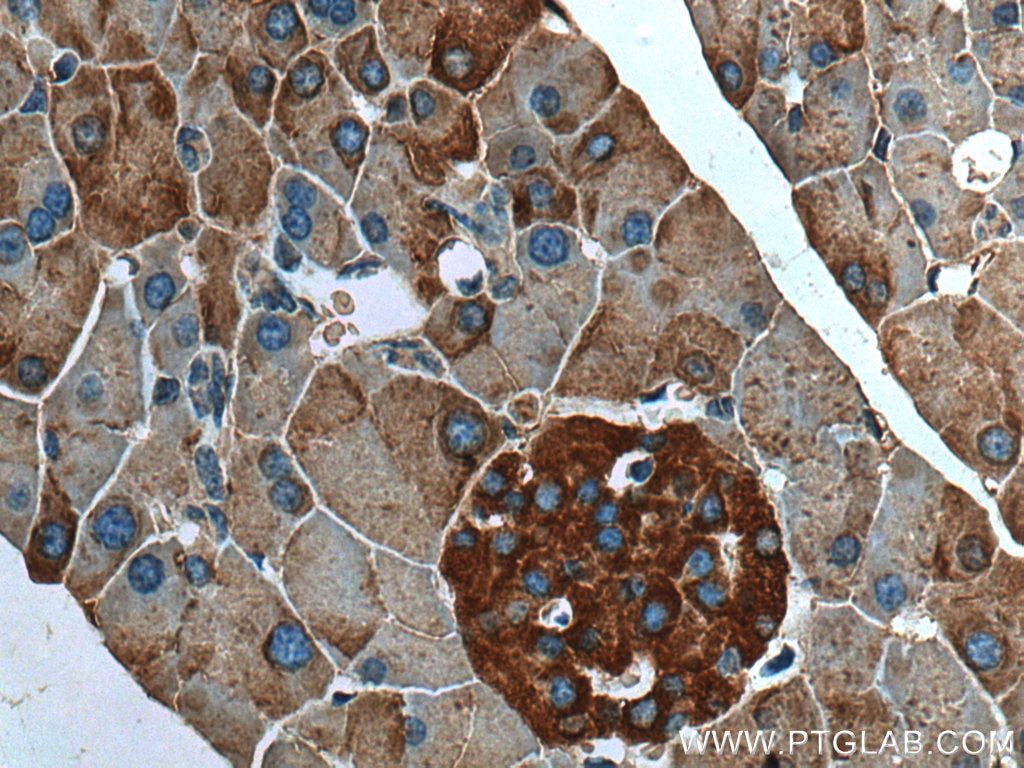 IHC staining of mouse pancreas using 67719-1-Ig