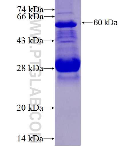 EIF3L fusion protein Ag1974 SDS-PAGE
