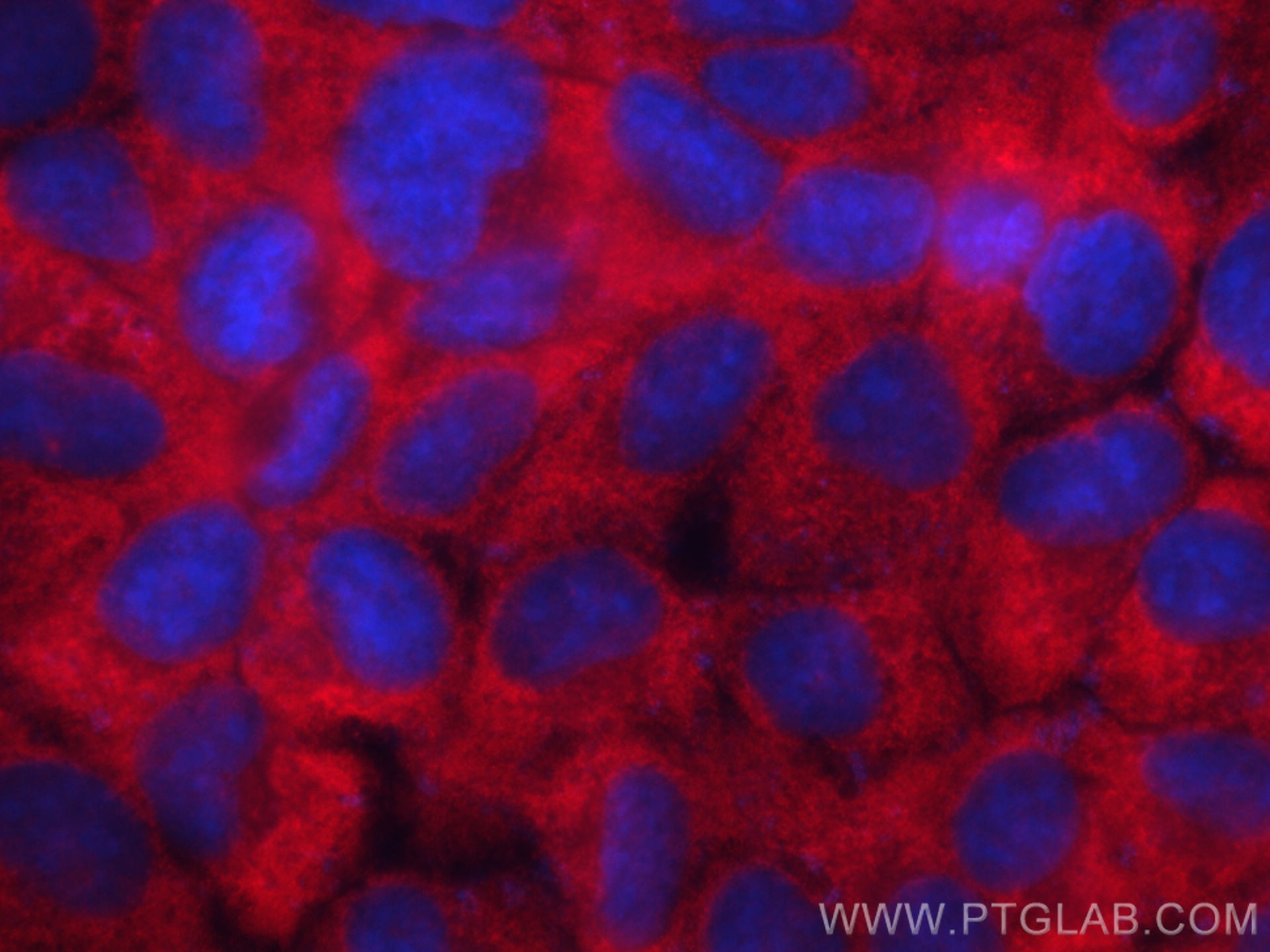Immunofluorescence (IF) / fluorescent staining of A431 cells using EIF3M Polyclonal antibody (11423-1-AP)