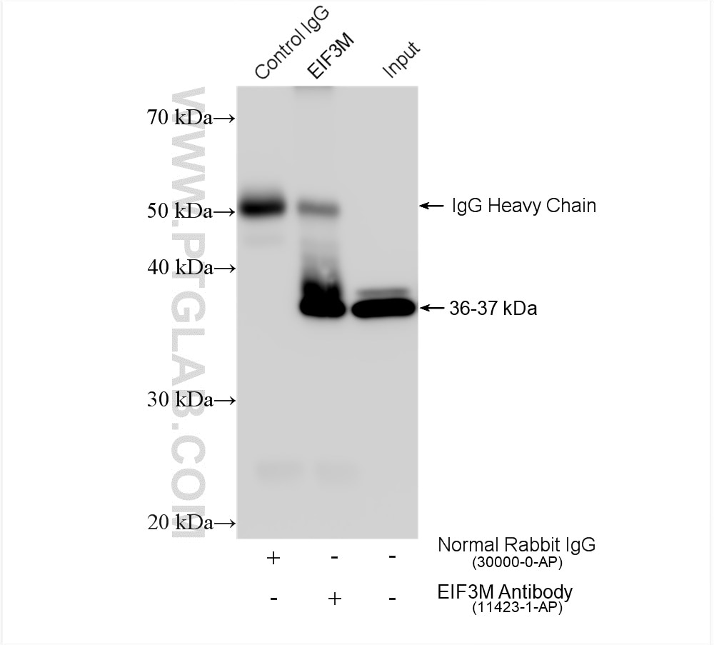Immunoprecipitation (IP) experiment of HeLa cells using EIF3M Polyclonal antibody (11423-1-AP)
