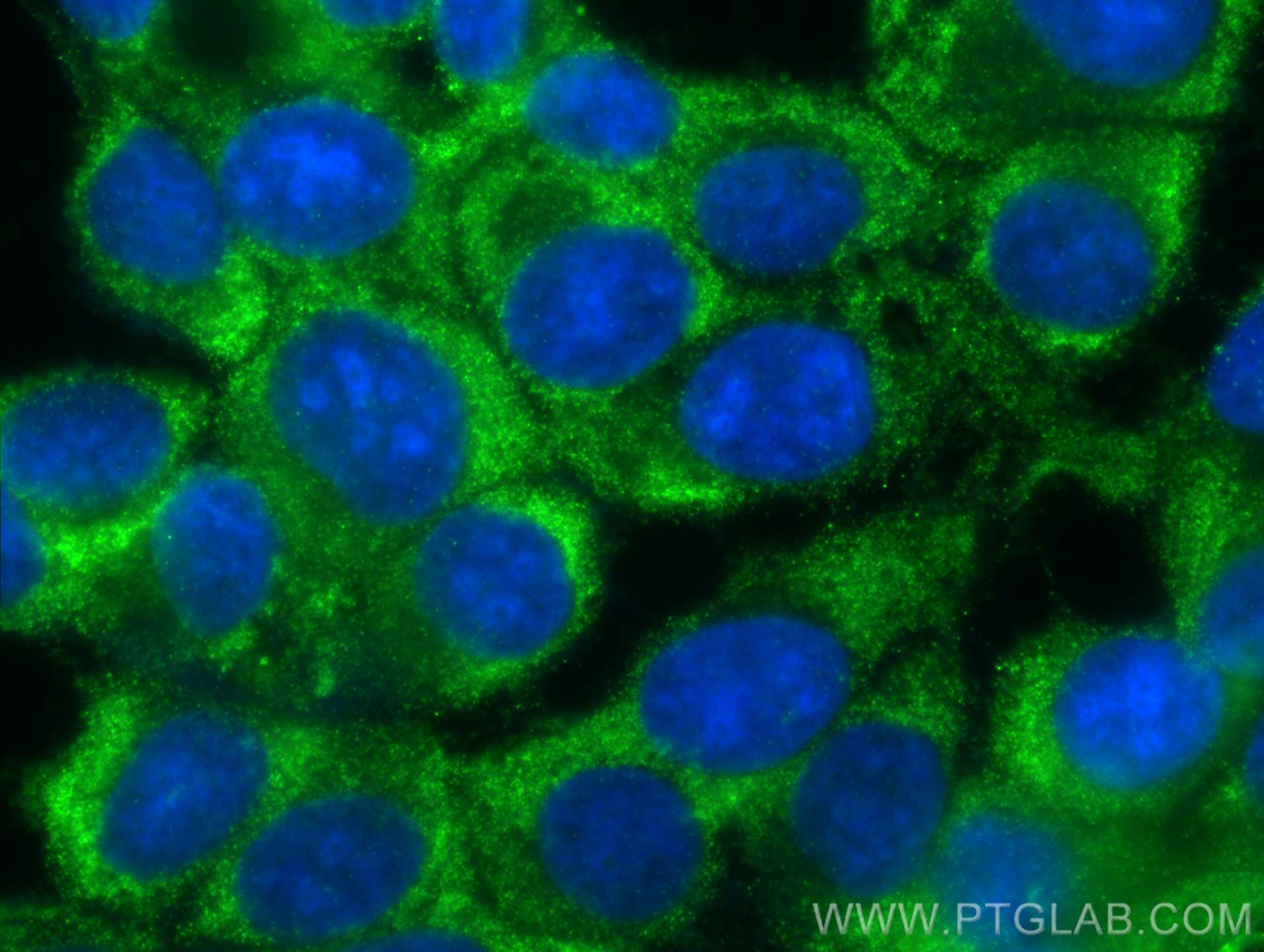 Immunofluorescence (IF) / fluorescent staining of MCF-7 cells using EIF3M Monoclonal antibody (66025-1-Ig)